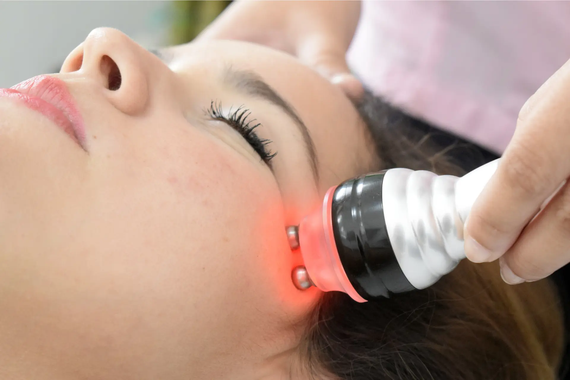 lifting facial sin cirugía
